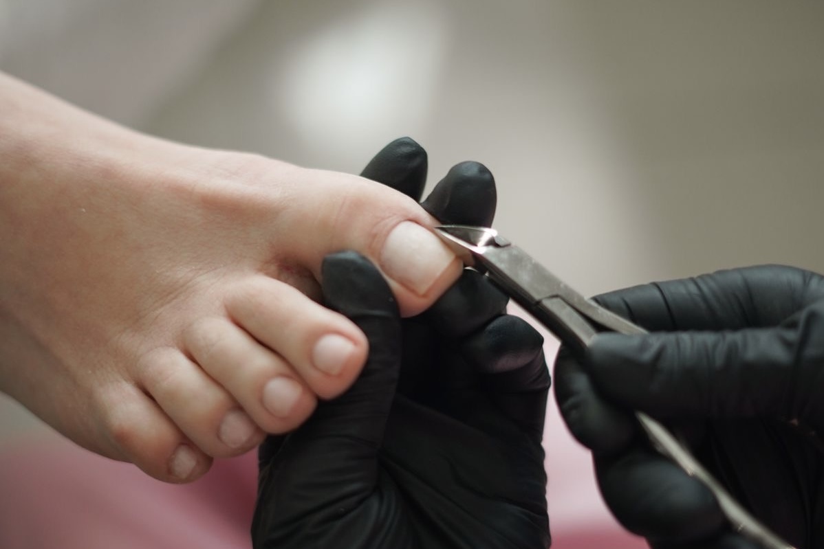 Ingrown 